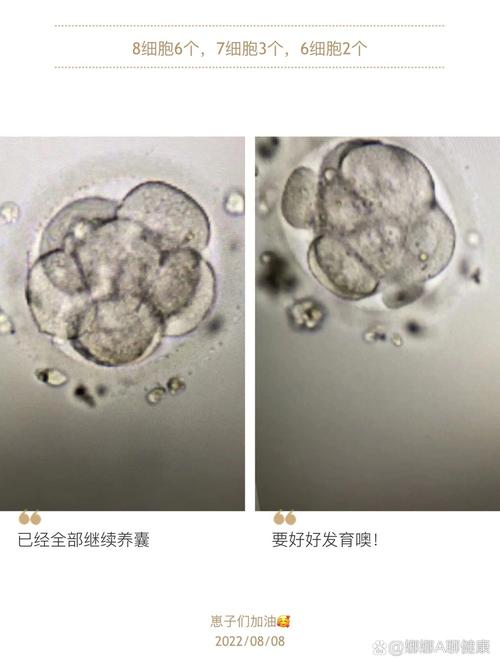 三天胚胎