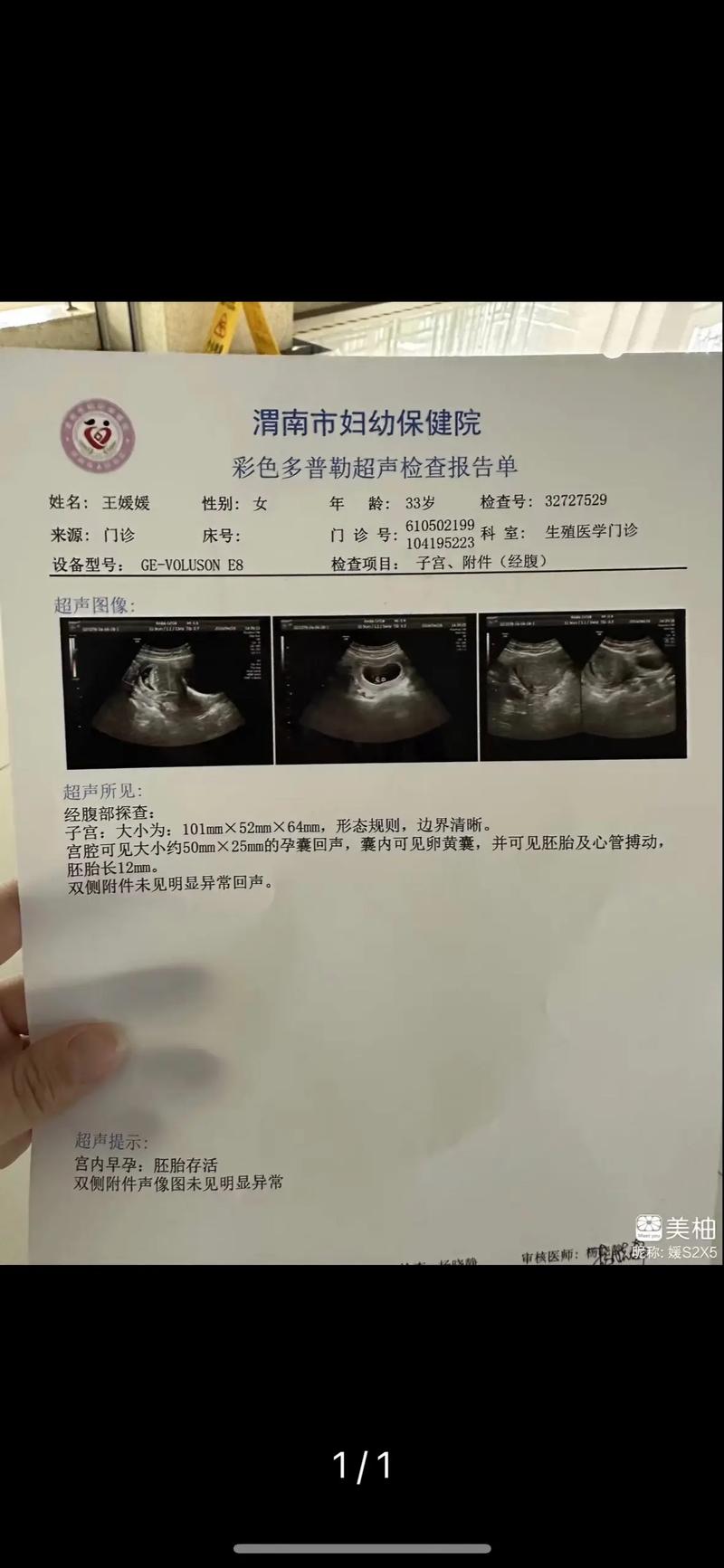 未长胎心
