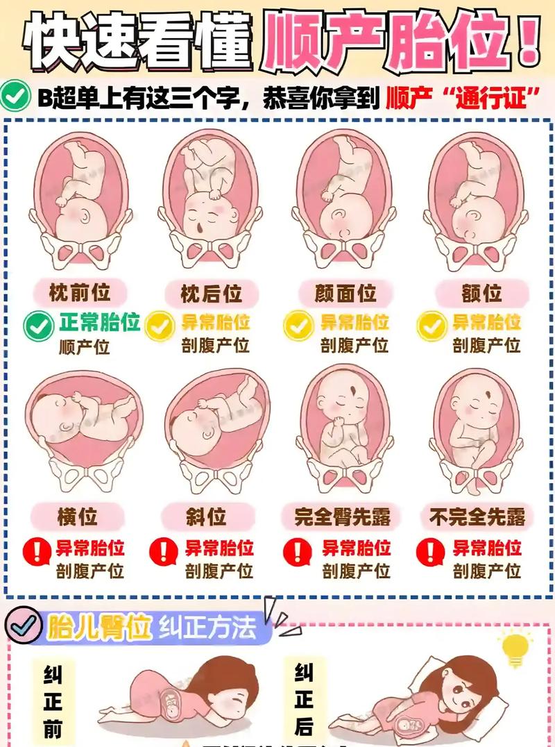 胎位问题