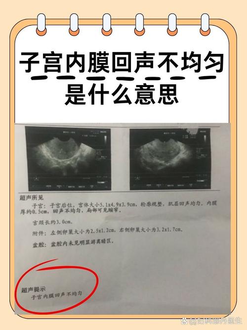  内膜最低值