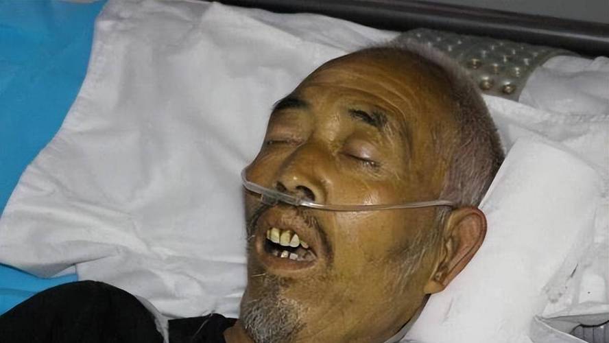 肝炎患者