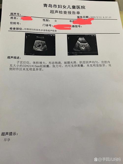 未见孕囊胚芽