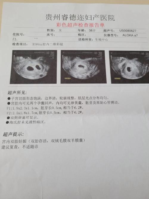 移植四周