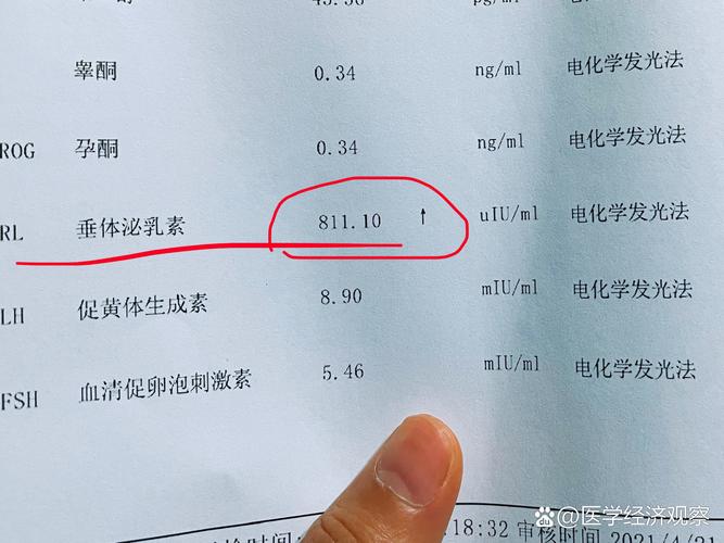 泌乳素升高