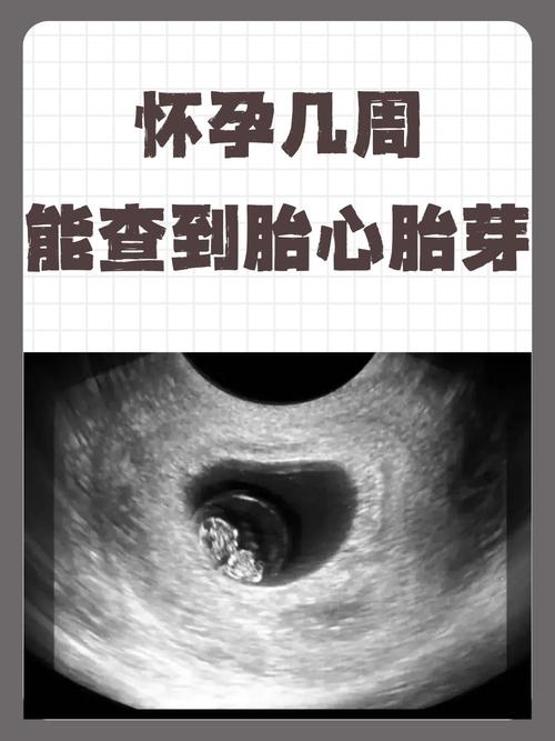 胎心发育