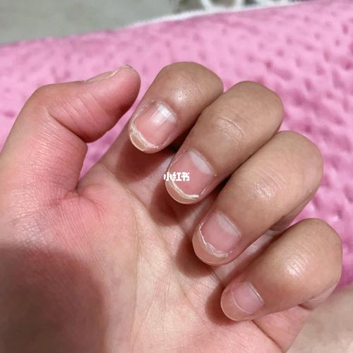 移植三个月