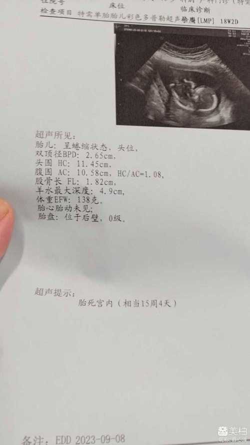 移植十八周