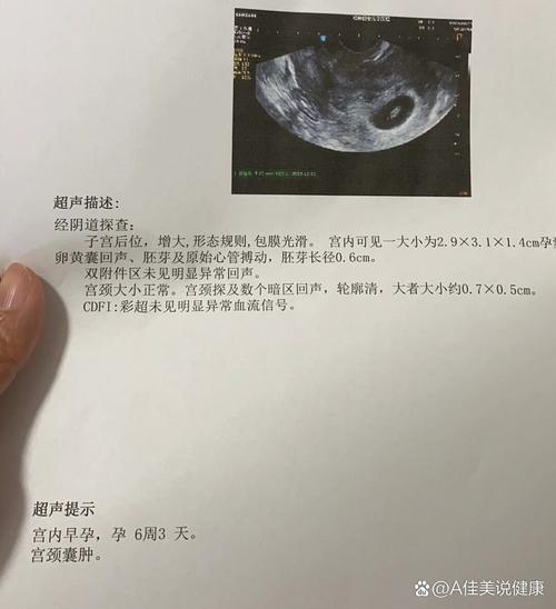 移植后29天