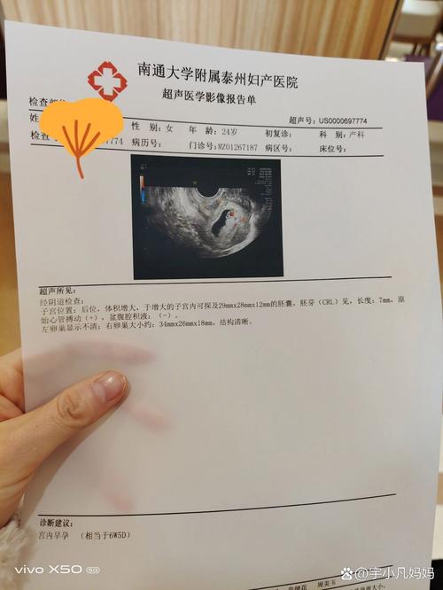 移植47天