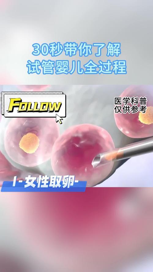 试管婴儿有效性