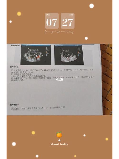 16周停胎