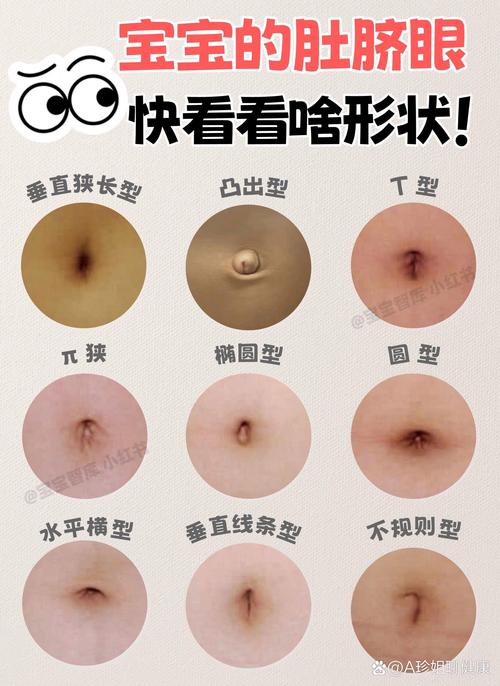  肚脐形成