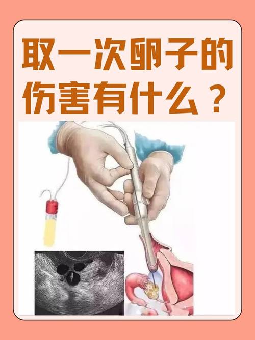 一次取两个卵