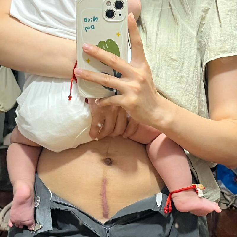 移植后肚子凉