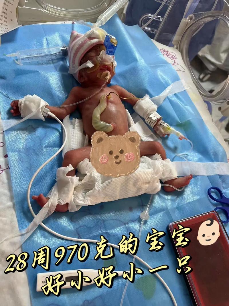 28周移植