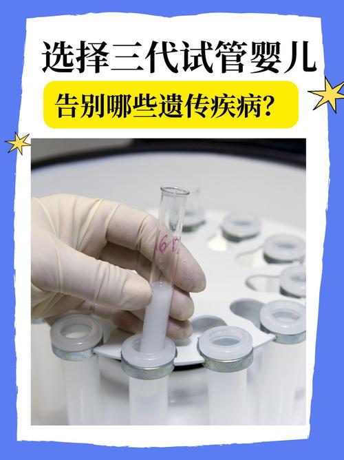遗传试管婴儿