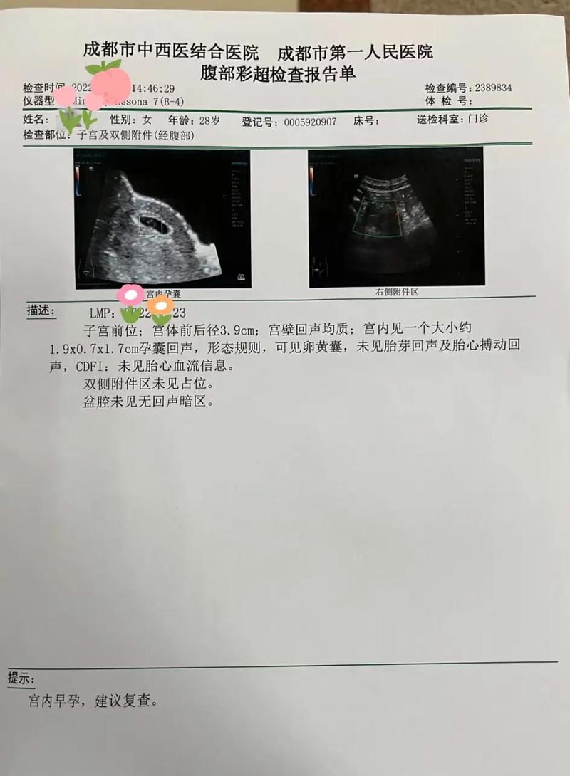  早孕检查