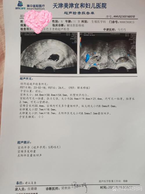 移植26天