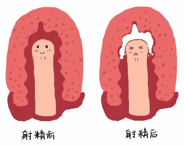  筛精术