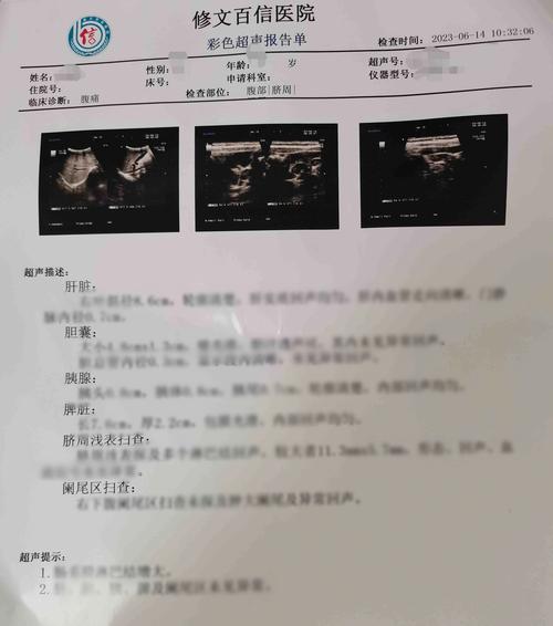 B超结果