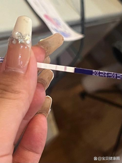 移植8周出血