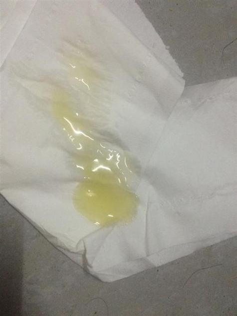  精子数量不足