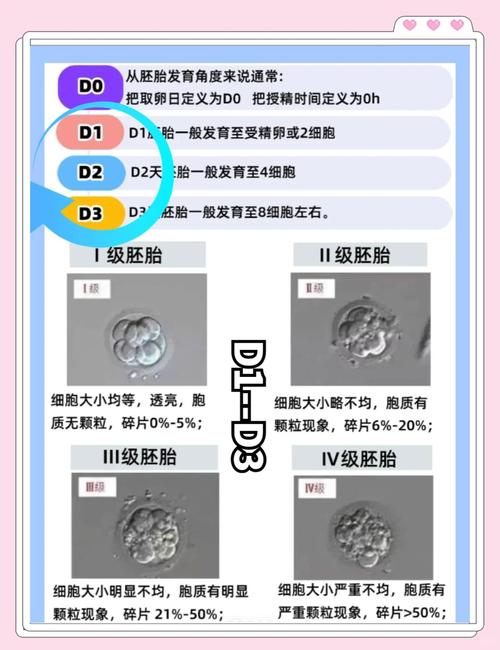  囊胚性别选择