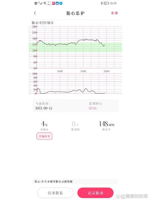 胎心搏动规律