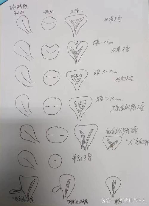 子宫形态异常