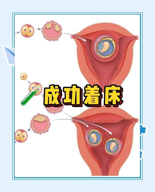 着床后发育