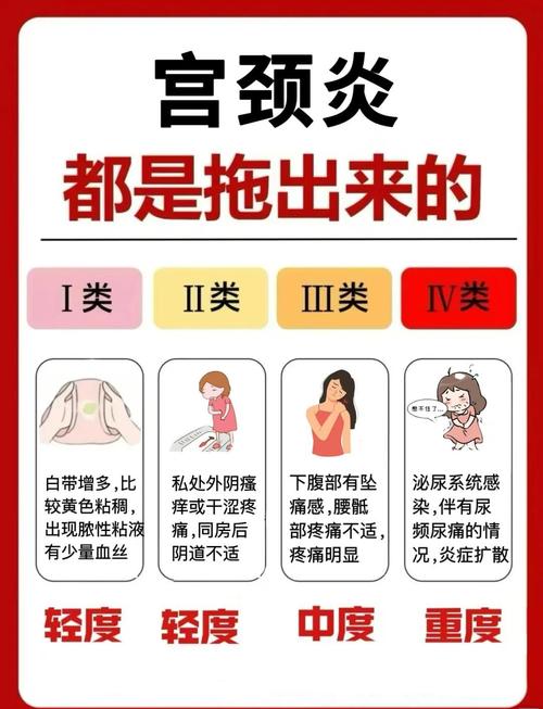 宫颈炎
