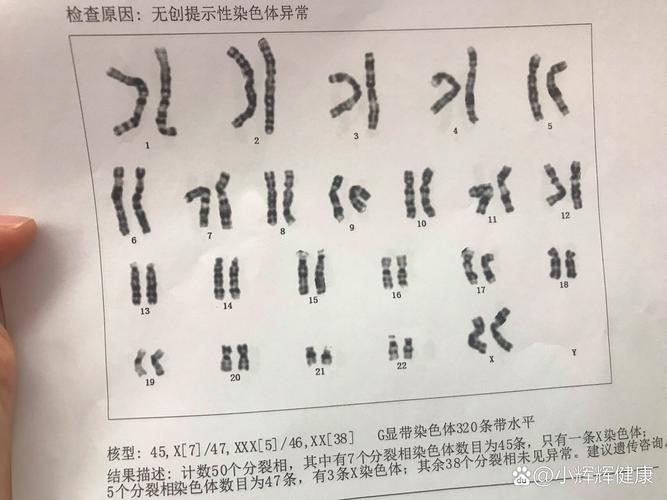 嵌合体概率