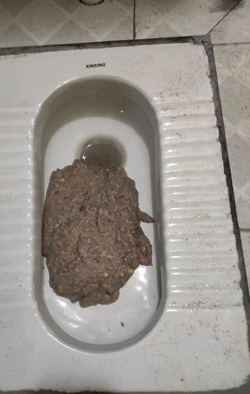 恶心