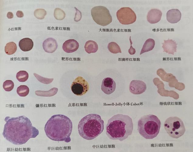 形态学异常