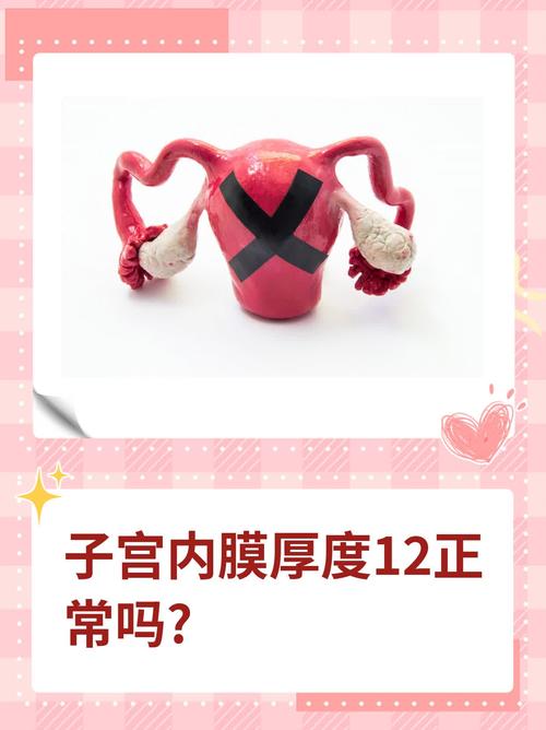 内膜12