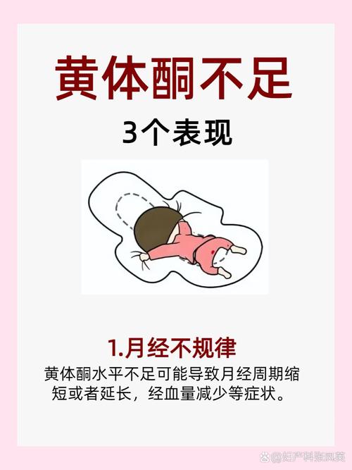  黄体功能不足