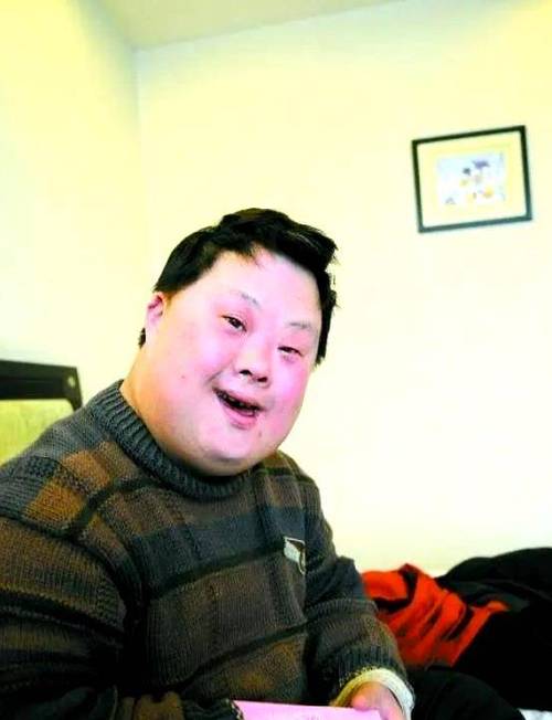 三体综合征