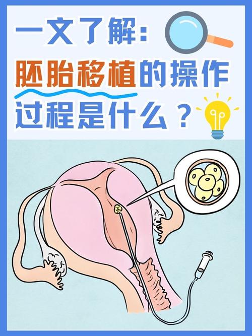 胚胎捐献