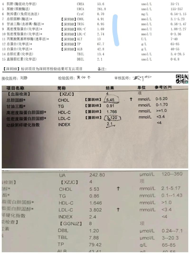 血流检查