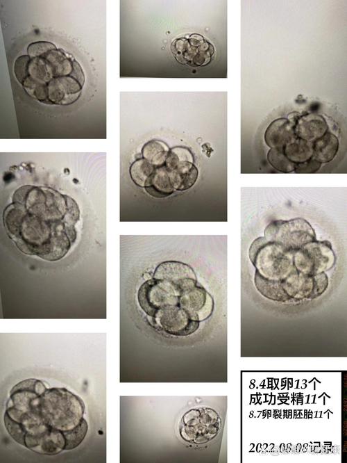  第三天胚胎