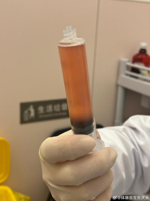 手术后积液