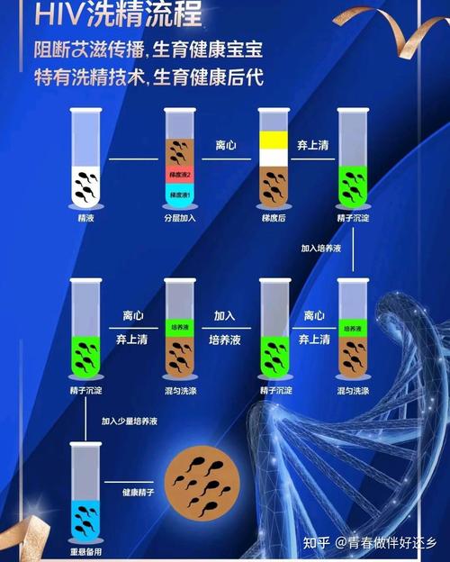 洗精技术
