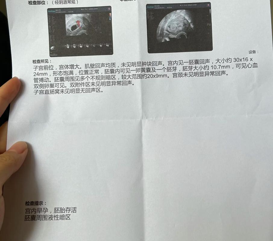 胚胎暗区
