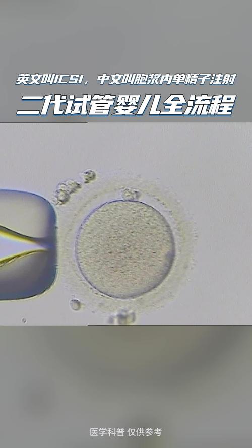 安徽试管婴儿二代