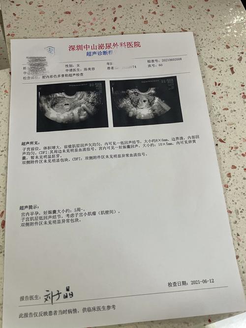 移植17天