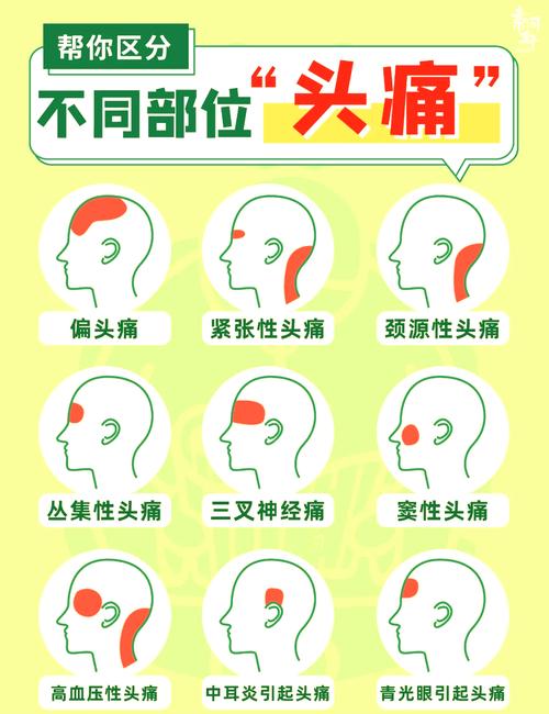 头痛原因