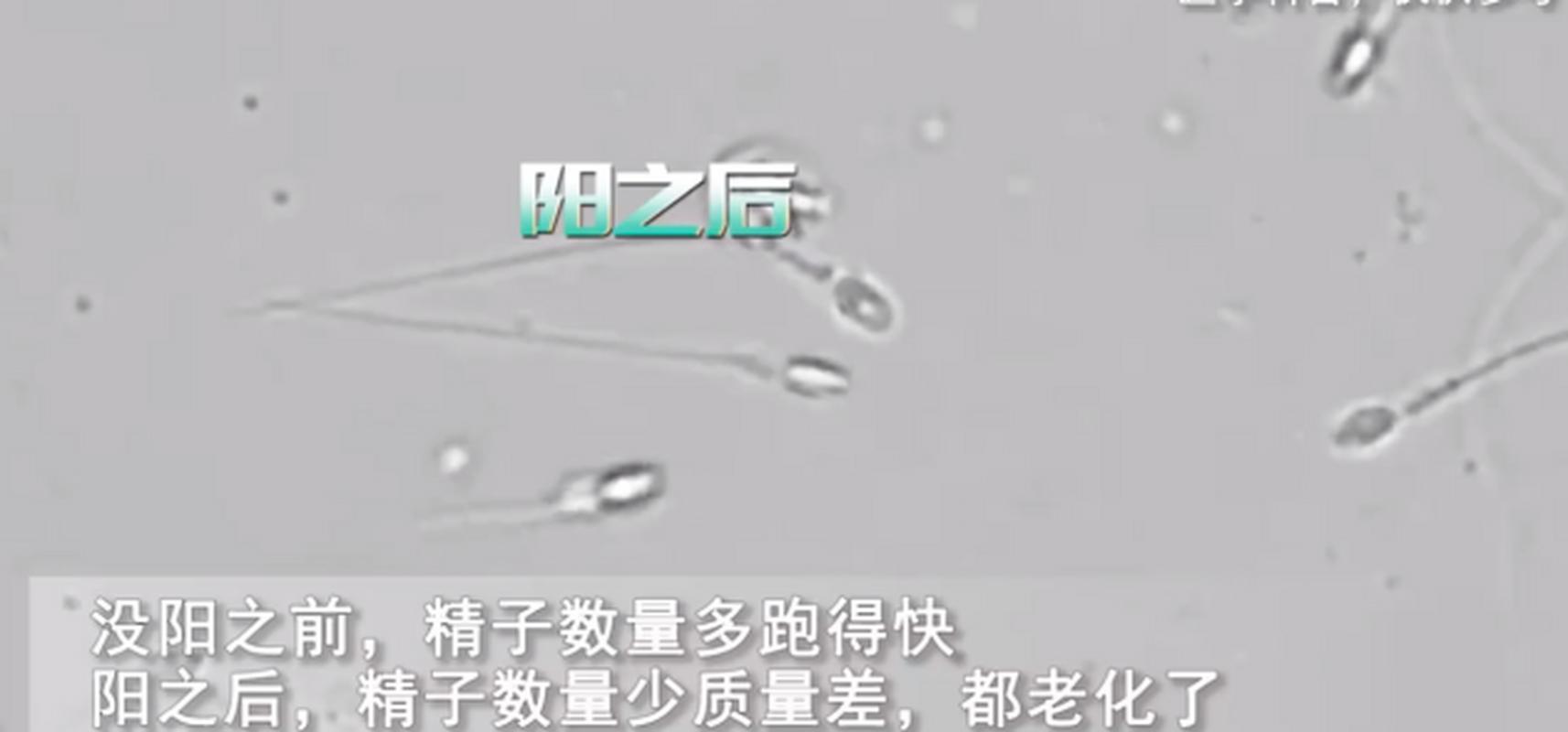  Y精子比例