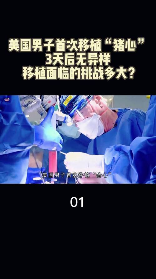  移植后挑战