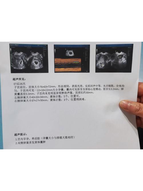 26天移植