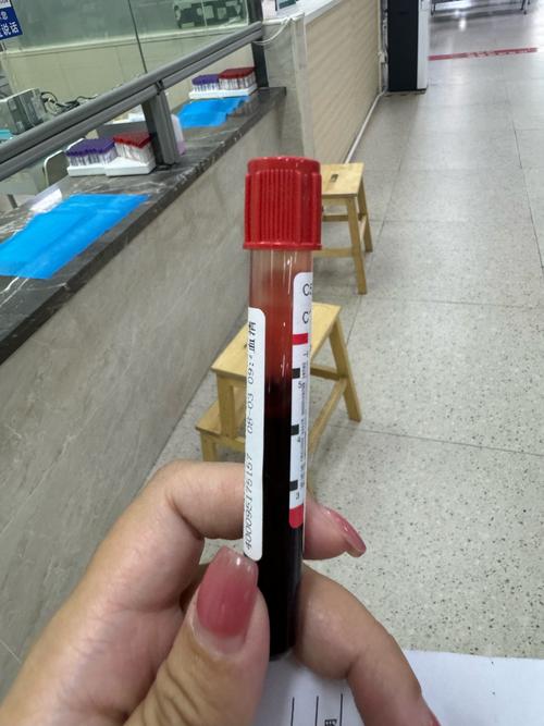 反复抽血